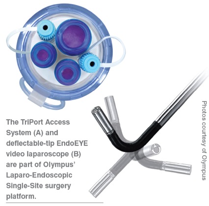 gallbladder removal through belly button. as gallbladder removal,