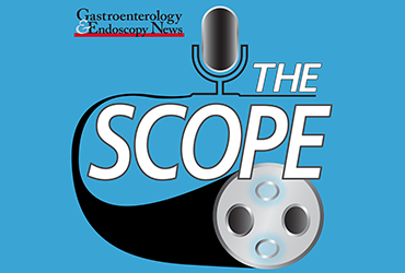 The Scope