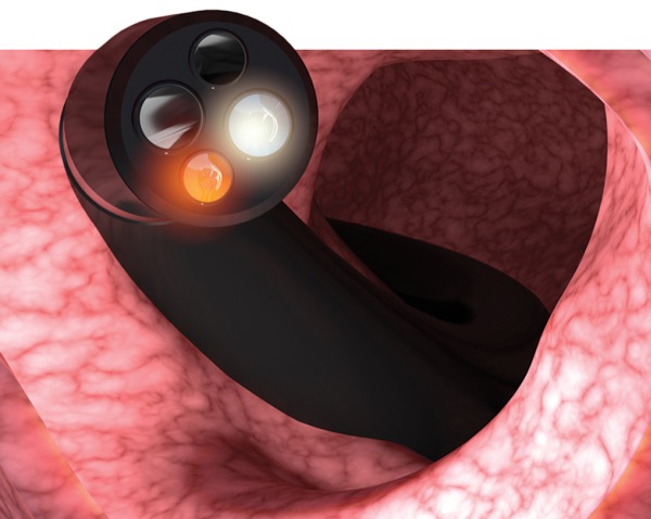 Sharma’s Endoscopy Insights: ESGE Guidelines, NERD Diagnosis And ...