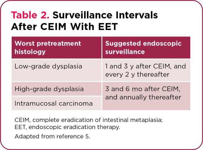 Endoscopy for Barrett’s Esophagus