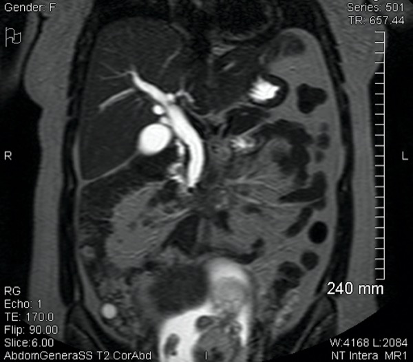 Improving the Safety of Endoscopy Procedures in Pregnant Patients