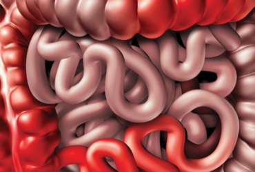 bpc-157 crohn's disease Stable Gastric Pentadecapeptide BPC 157 as a Therapy and Safety Key: A  Special Beneficial Pleiotropic Effect Controlling and Modulating  Angiogenesis and the NO-System main image 0