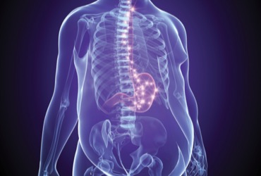 what to not eat on semaglutide Ozempic® Foods to Avoid: Reducing Side Effects