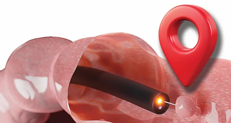 Polyp Locations Shutterstock