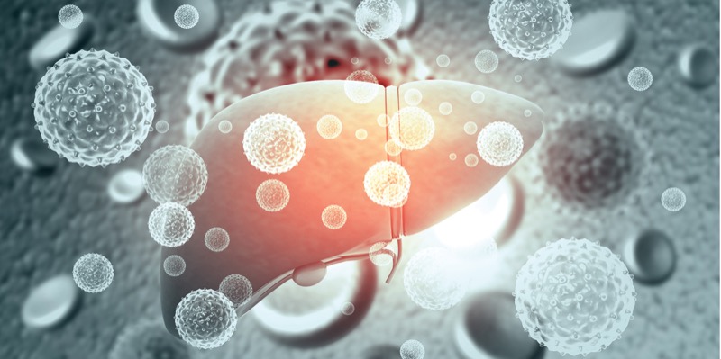 Liver Infection with hepatitis - Adobe Stock
