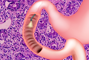 transcend glp 1 probiotic Pendulum Therapeutics Introduces GLP-1 Probiotic