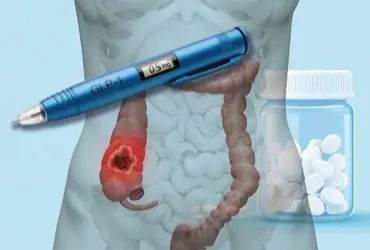 can i take aspirin with semaglutide GLP1 Therapy Linked Lower Colon Cancer Risk vs Aspirin