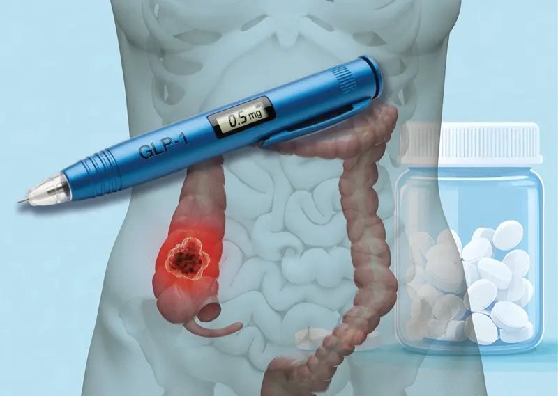 can i take aspirin with semaglutide GLP1 Therapy Linked Lower Colon Cancer Risk vs Aspirin