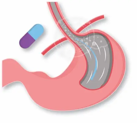glp-1+gip A pathophysiological update of the incretins